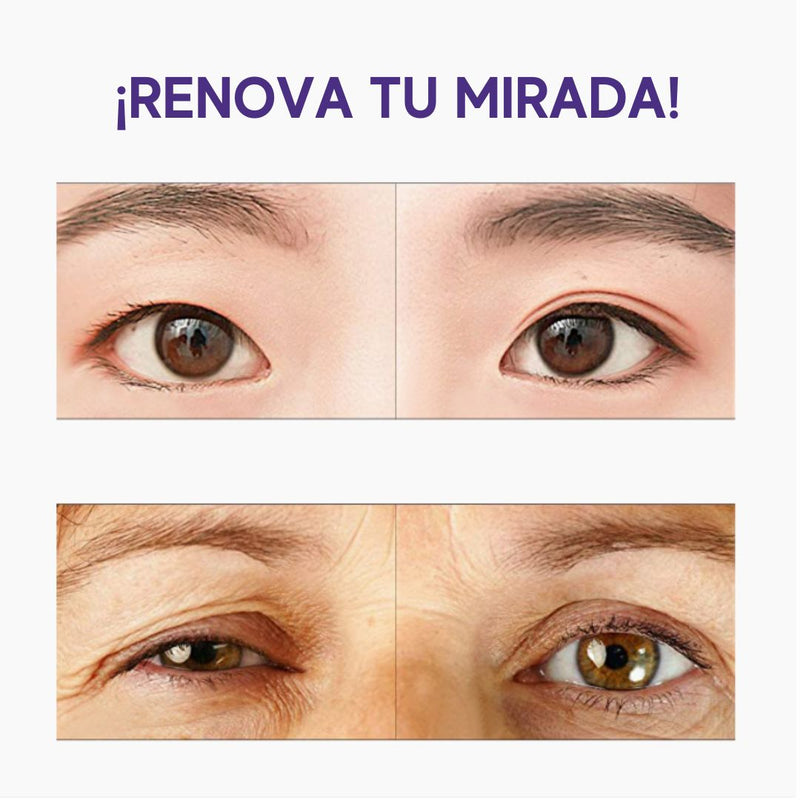 Beauty Eye- Levantador de Párpados - (1200 piezas)